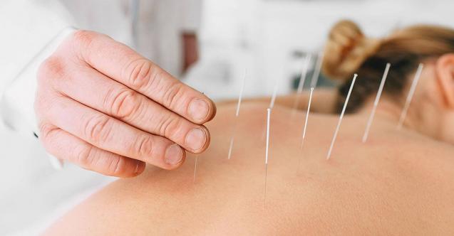 DSÖ Şu Sorunlarda Akupunktur Kullanılabilir Dedi