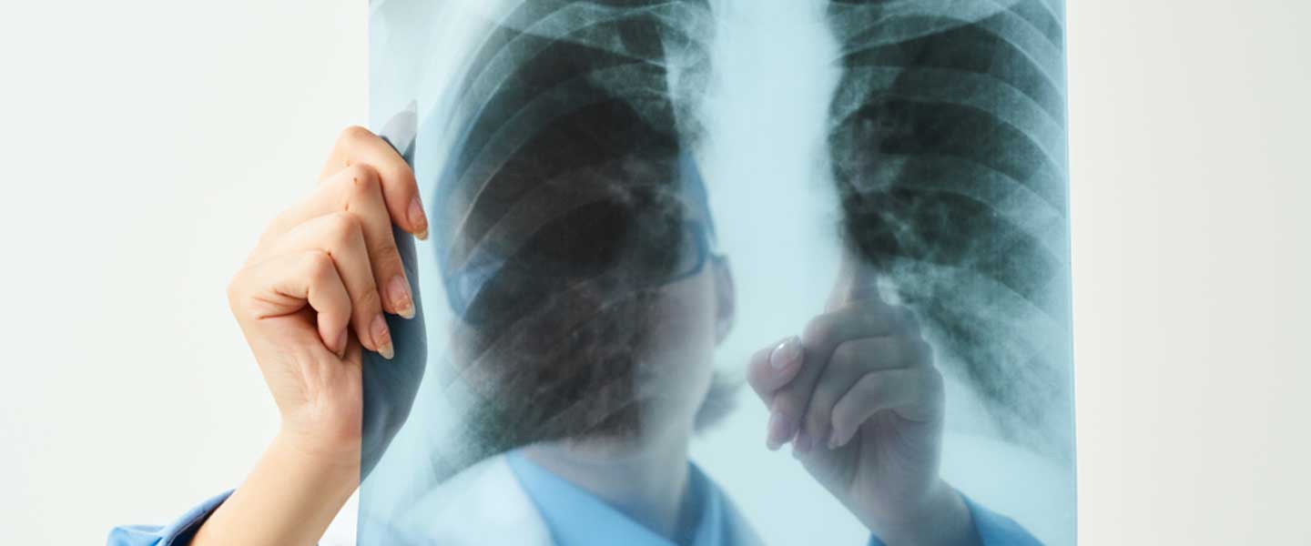 Dikkat Akciğer Embolisi Olma Riskiniz Olabilir